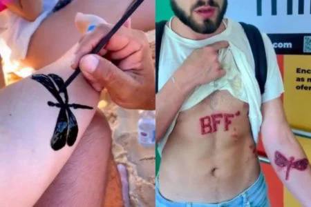Jovem faz tatuagem de henna e provoca queimadura grave; VEJA VÍDEO