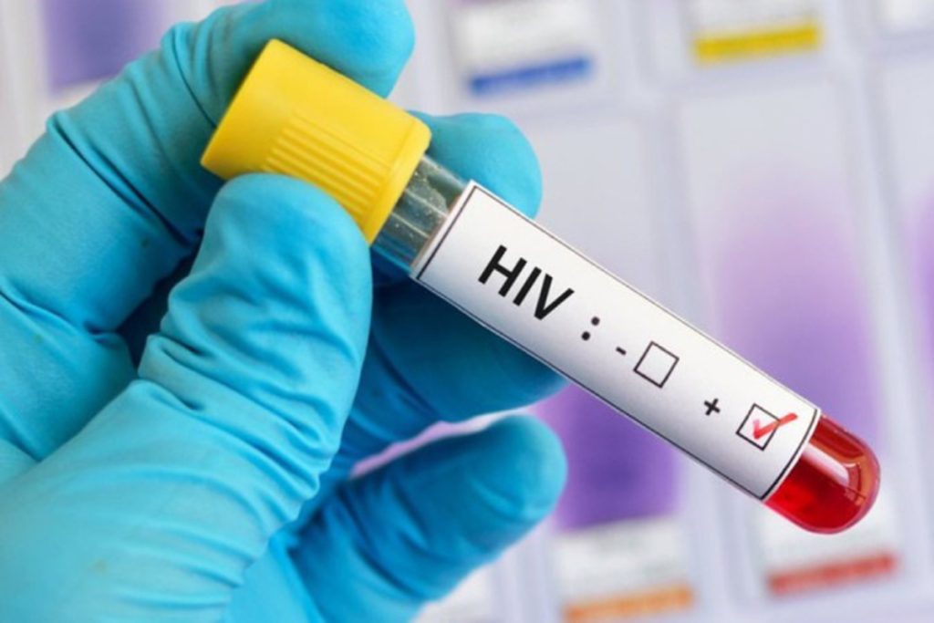 Ministério da Saúde informa que 108 mil brasileiros são HIV positivo e não sabem