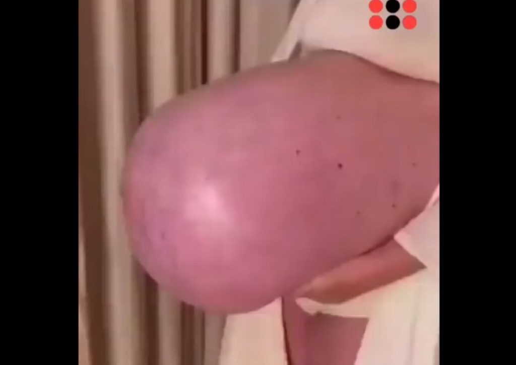 Mulher impressiona a web após compartilhar o tamanho de sua barriga durante a gestação; VEJA VÍDEO