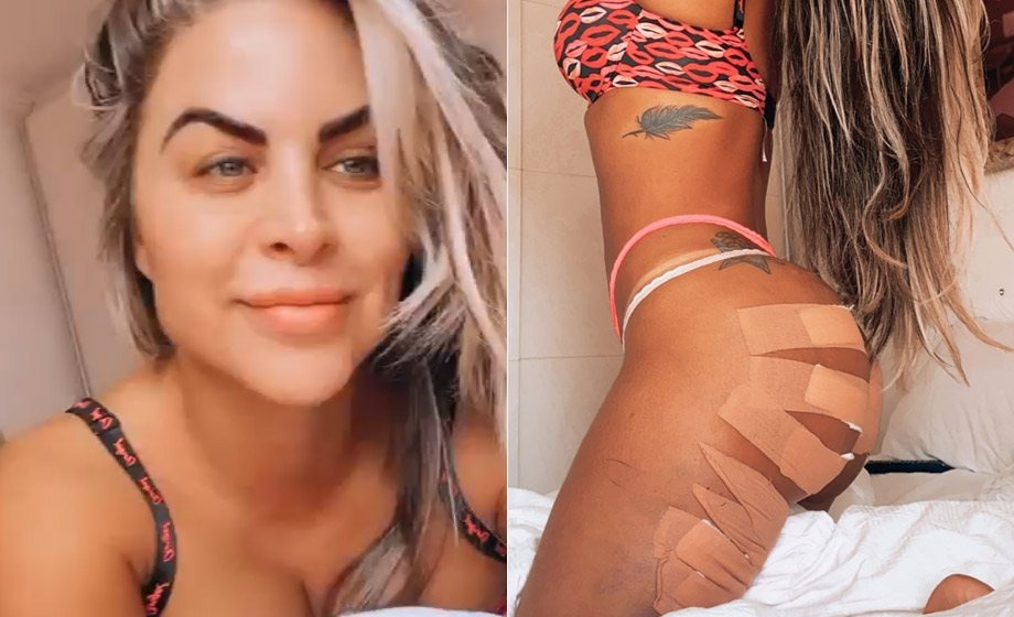 Ex-assistente de João Kléber faz rejuvenescimento íntimo, aos 44 anos: “Novinha”