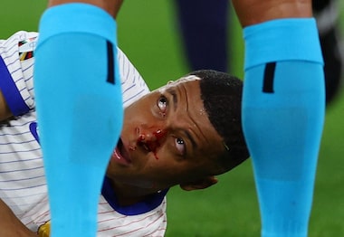 O atacante francês Kylian Mbappé quebrou o nariz durante a partida entre França e Áustria, válida pela Eurocopa 2024.