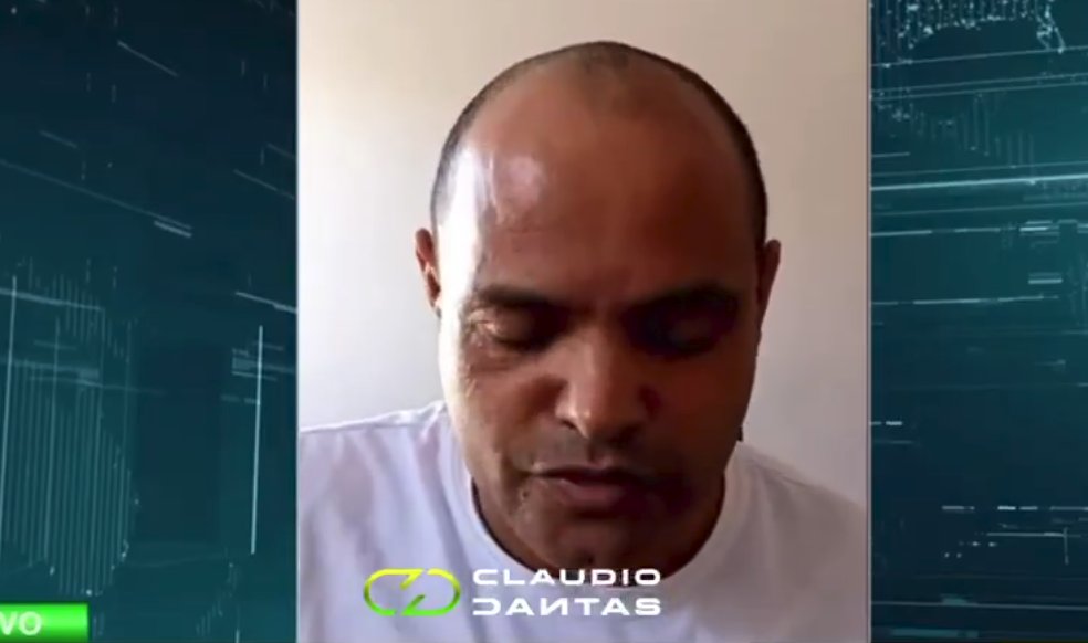 ALive: Ex-motorista da Embaixada da Índia critica demissão após câncer e amputação